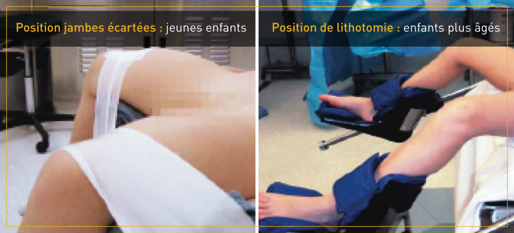 PatientPositioning_image-1024x465-fr